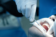 Foto-Cirurgia-Oral-menor-1