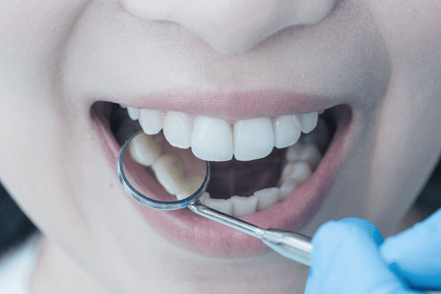 Foto-endodontia-1