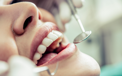 Por que é importante realizar limpeza dentária periodicamente?