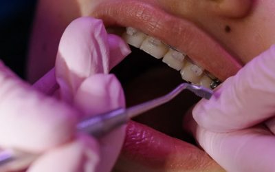 Qual a diferença entre Ortodontia preventiva e Ortodontia corretiva?