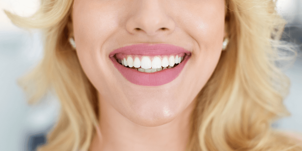 Perigos do Clareamento Dental Caseiro