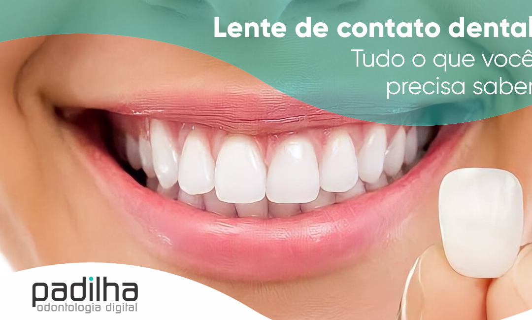 Lente de Contato Dental | Tudo o Que Você Precisa Saber