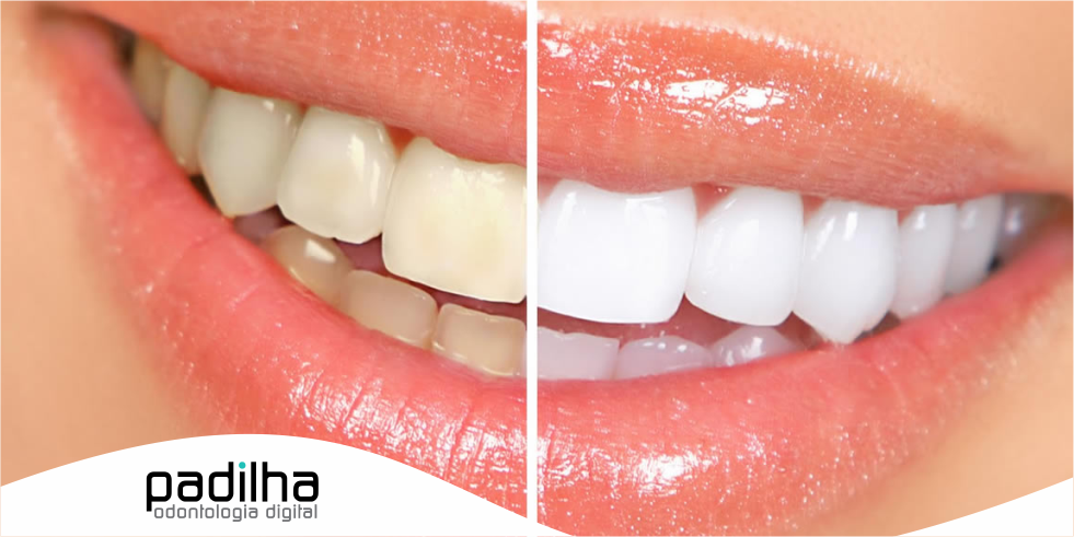 odontologia-estetica