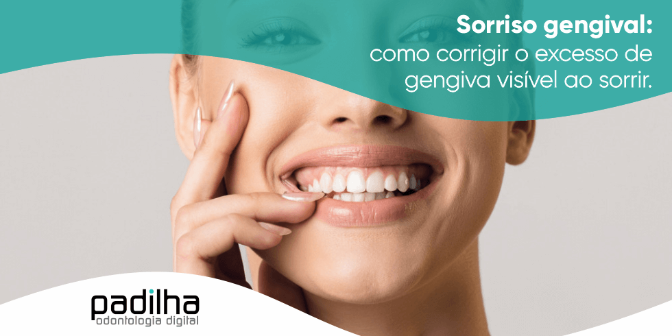 Sorriso Gengival: Como Corrigir o Excesso de Gengiva Visível ao Sorrir