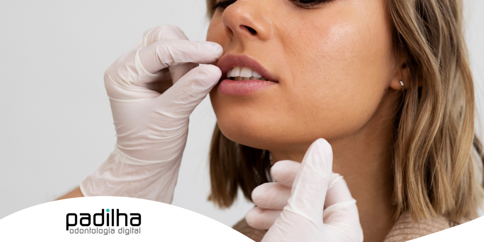 Odontologia e Toxina Botulínica: Conheça os Benefícios Funcionais e Estéticos