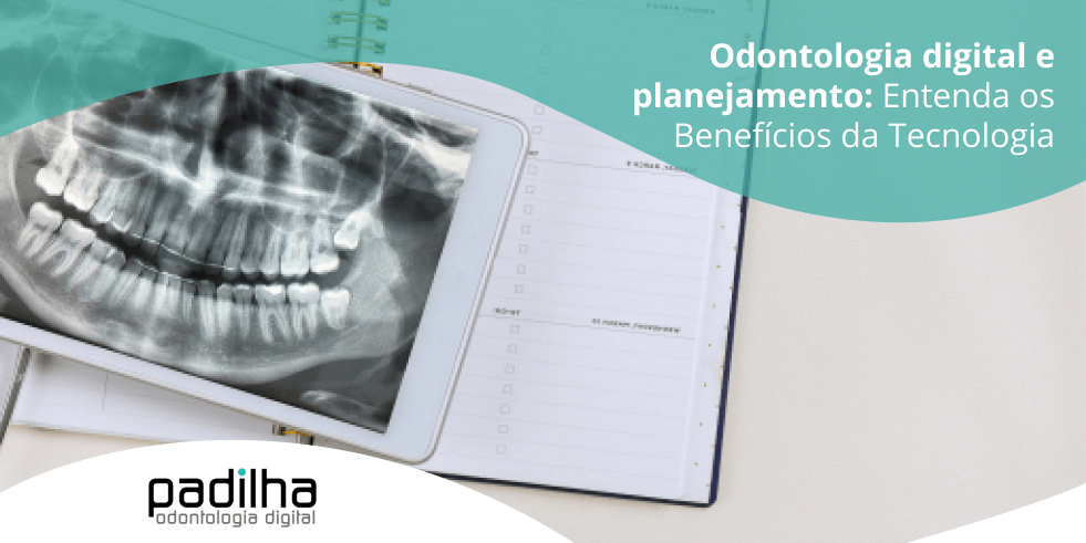 Odontologia Digital e Planejamento: Entenda os Benefícios da Tecnologia