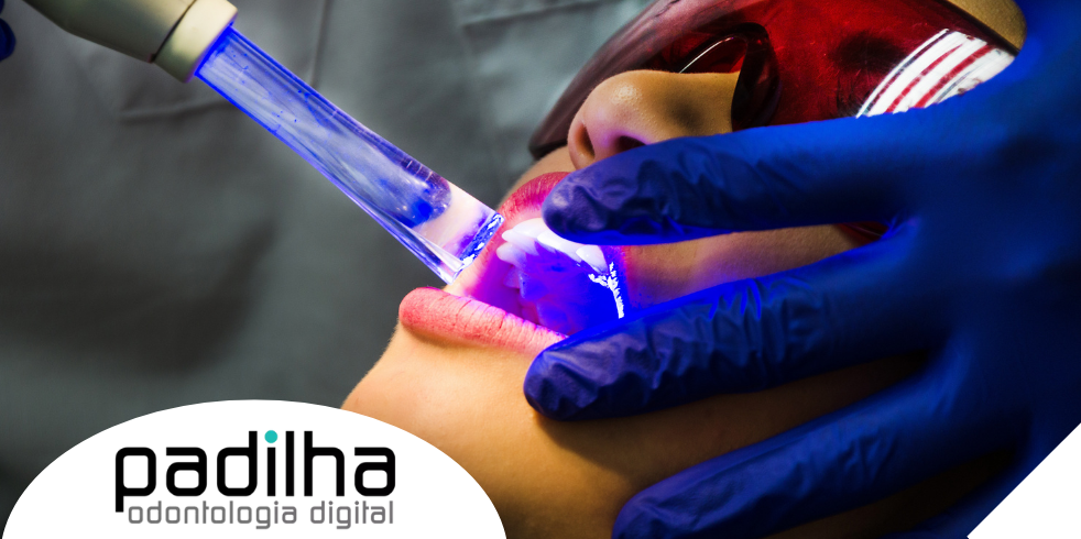 Tratamentos a Laser na Odontologia: Benefícios e Indicações

