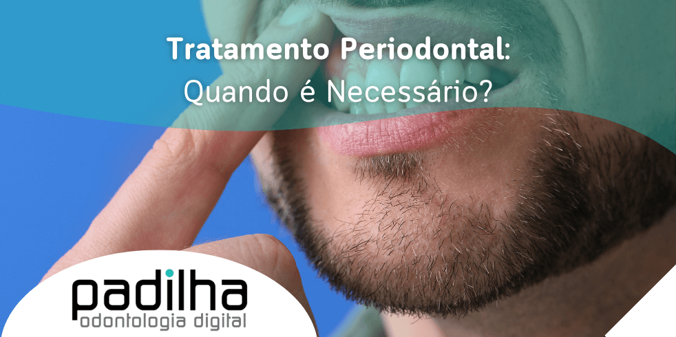 Tratamento Periodontal: Quando É Necessário?