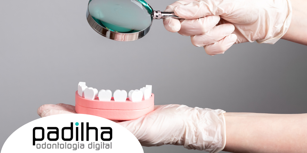 Tratamento Periodontal: Quando É Necessário? 